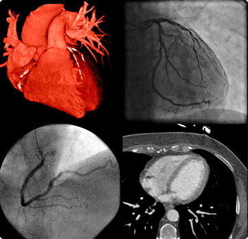 interventional and surgical cardiology procedure